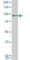 Ubiquitin Like With PHD And Ring Finger Domains 1 antibody, H00029128-M02, Novus Biologicals, Western Blot image 