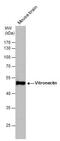 Vitronectin antibody, PA5-27909, Invitrogen Antibodies, Western Blot image 