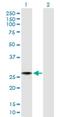 Translation Machinery Associated 16 Homolog antibody, H00055319-B01P, Novus Biologicals, Western Blot image 