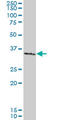 SMAD Family Member 3 antibody, LS-B5459, Lifespan Biosciences, Western Blot image 