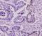 Small Ubiquitin Like Modifier 2 antibody, GTX50000, GeneTex, Immunohistochemistry paraffin image 