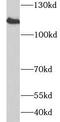Prominin-1 antibody, FNab01419, FineTest, Western Blot image 