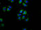 Solute Carrier Family 27 Member 1 antibody, LS-C681362, Lifespan Biosciences, Immunofluorescence image 
