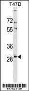 Ring Finger Protein 138 antibody, 59-317, ProSci, Western Blot image 