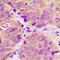 Protein Phosphatase 1 Regulatory Inhibitor Subunit 1B antibody, GTX55025, GeneTex, Immunohistochemistry paraffin image 