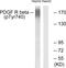 Platelet Derived Growth Factor Receptor Beta antibody, LS-C199421, Lifespan Biosciences, Western Blot image 