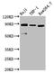 MS2 antibody, LS-C669873, Lifespan Biosciences, Western Blot image 