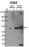 DEK Proto-Oncogene antibody, 720215, Invitrogen Antibodies, Immunoprecipitation image 