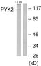 Protein Tyrosine Kinase 2 Beta antibody, LS-C117576, Lifespan Biosciences, Western Blot image 