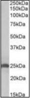 Apolipoprotein D antibody, orb181579, Biorbyt, Western Blot image 