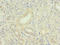 TNF Superfamily Member 12 antibody, LS-C376903, Lifespan Biosciences, Immunohistochemistry paraffin image 