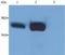 Lymphocyte Cytosolic Protein 2 antibody, NB500-537, Novus Biologicals, Western Blot image 