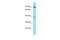 Family With Sequence Similarity 83 Member G antibody, A10465, Boster Biological Technology, Western Blot image 