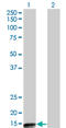 Protein Phosphatase 3 Regulatory Subunit B, Beta antibody, LS-C197976, Lifespan Biosciences, Western Blot image 