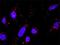 Axin 1 antibody, H00008312-M01, Novus Biologicals, Proximity Ligation Assay image 
