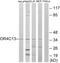 Olfactory Receptor Family 4 Subfamily C Member 13 antibody, GTX87901, GeneTex, Western Blot image 