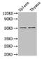 Tubulin Beta 3 Class III antibody, LS-C211968, Lifespan Biosciences, Western Blot image 