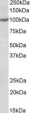 Ubiquitin Specific Peptidase 4 antibody, MBS421209, MyBioSource, Western Blot image 