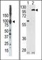 Protein Kinase C Epsilon antibody, AP13548PU-N, Origene, Western Blot image 