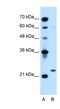 Immunoglobulin Lambda Like Polypeptide 1 antibody, NBP1-58333, Novus Biologicals, Western Blot image 