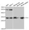 Tissue Factor Pathway Inhibitor antibody, abx001368, Abbexa, Western Blot image 