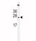 Succinate Dehydrogenase Complex Subunit D antibody, F41948-0.4ML, NSJ Bioreagents, Western Blot image 