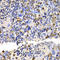 Ubiquitin Conjugating Enzyme E2 V2 antibody, LS-C349009, Lifespan Biosciences, Immunohistochemistry frozen image 