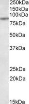 Transporter 1, ATP Binding Cassette Subfamily B Member antibody, EB08872, Everest Biotech, Western Blot image 