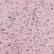 Calc antibody, A02352, Boster Biological Technology, Immunohistochemistry paraffin image 