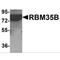 Epithelial Splicing Regulatory Protein 2 antibody, MBS150050, MyBioSource, Western Blot image 