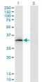 Homeobox B9 antibody, H00003219-M03, Novus Biologicals, Western Blot image 