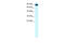 Solute Carrier Family 4 Member 1 (Diego Blood Group) antibody, 27-948, ProSci, Western Blot image 