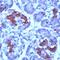 PMP-22 antibody, PA5-32548, Invitrogen Antibodies, Immunohistochemistry frozen image 