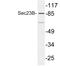 SEC23 Homolog B, Coat Complex II Component antibody, LS-C177311, Lifespan Biosciences, Western Blot image 