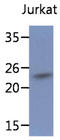 Translocon-associated protein subunit beta antibody, LS-C200860, Lifespan Biosciences, Western Blot image 