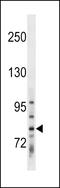 TBC1 Domain Containing Kinase antibody, LS-C157149, Lifespan Biosciences, Western Blot image 