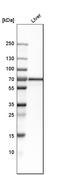 Solute Carrier Family 27 Member 5 antibody, HPA007292, Atlas Antibodies, Western Blot image 