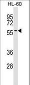 Interferon Related Developmental Regulator 2 antibody, LS-C159886, Lifespan Biosciences, Western Blot image 