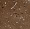 Chromosome 11 Open Reading Frame 87 antibody, NBP1-81296, Novus Biologicals, Immunohistochemistry paraffin image 