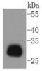 Major Histocompatibility Complex, Class II, DR Alpha antibody, NBP2-67610, Novus Biologicals, Western Blot image 