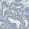 Asparaginase Like 1 antibody, MA5-24629, Invitrogen Antibodies, Immunohistochemistry frozen image 