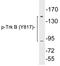 Neurotrophic Receptor Tyrosine Kinase 2 antibody, LS-C291539, Lifespan Biosciences, Western Blot image 