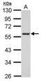 Myocyte Enhancer Factor 2C antibody, PA5-28247, Invitrogen Antibodies, Western Blot image 