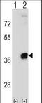 Phosphoribosyl Pyrophosphate Synthetase 2 antibody, LS-C162179, Lifespan Biosciences, Western Blot image 