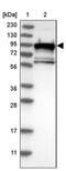 Slingshot Protein Phosphatase 3 antibody, PA5-54123, Invitrogen Antibodies, Western Blot image 