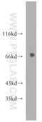 Ubiquitin Specific Peptidase 2 antibody, 15404-1-AP, Proteintech Group, Western Blot image 