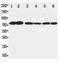 B-Raf Proto-Oncogene, Serine/Threonine Kinase antibody, PA1848, Boster Biological Technology, Western Blot image 