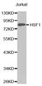 Heat Shock Transcription Factor 1 antibody, STJ24084, St John