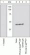 cAMP-dependent protein kinase catalytic subunit beta antibody, GTX25816, GeneTex, Western Blot image 
