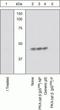 Protein Kinase CAMP-Activated Catalytic Subunit Beta antibody, GTX25816, GeneTex, Western Blot image 